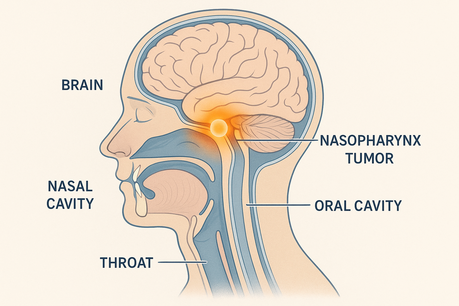 비인두암 설명을 위한 2d 해부학적 일러스트, 주황색 표시는 비인두암 종양이 생기는 부위