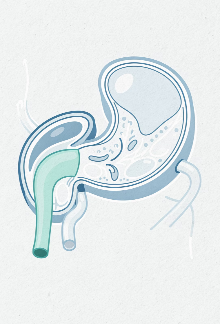 오른쪽 옆구리 통증 의심되는병