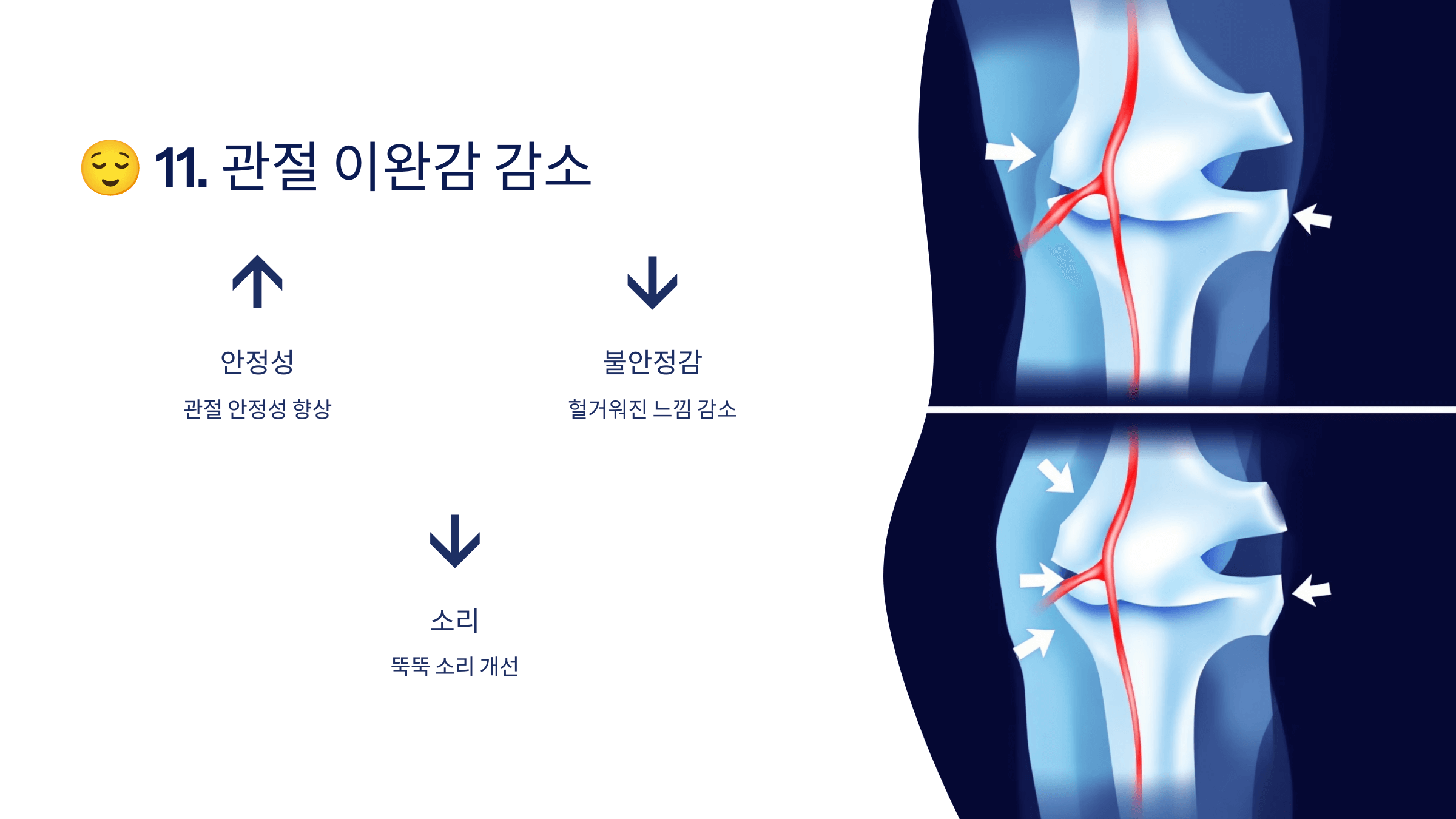 콘드로이친과 관련된 사진입니다.