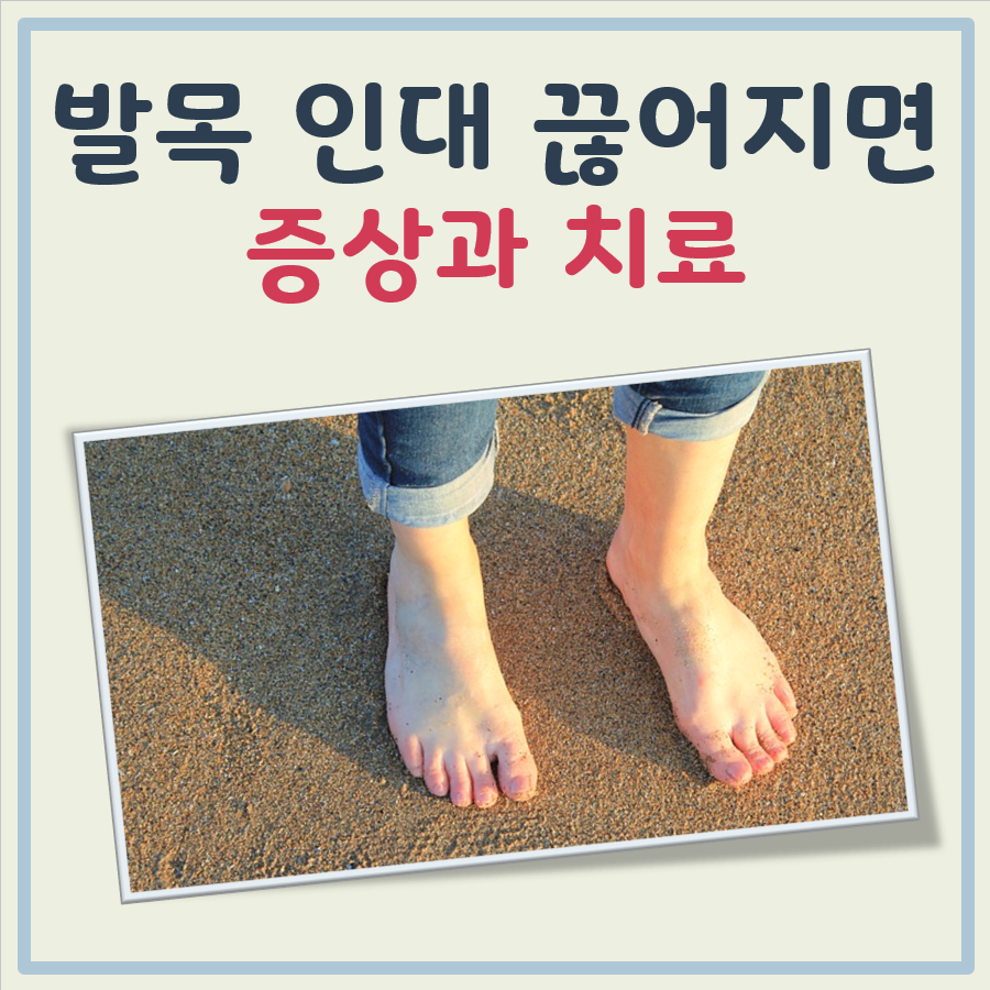 발목 인대 끊어지면 대표 이미지