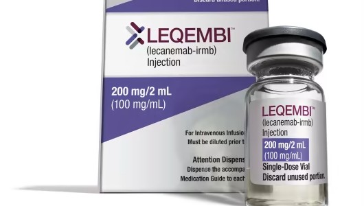 초기 알츠하이머 늦추는 방법 - 신약 레카네맙