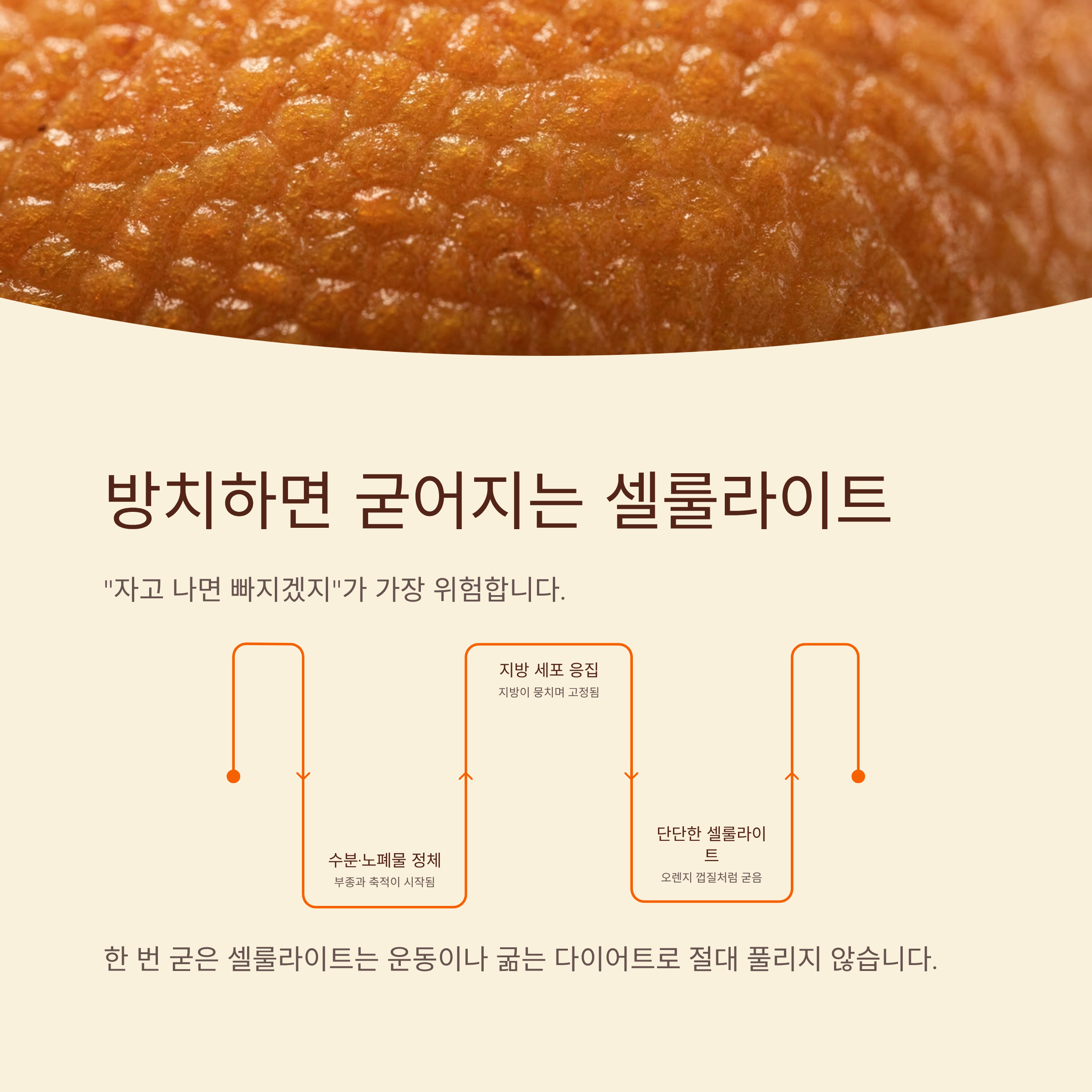 셀룰라이트