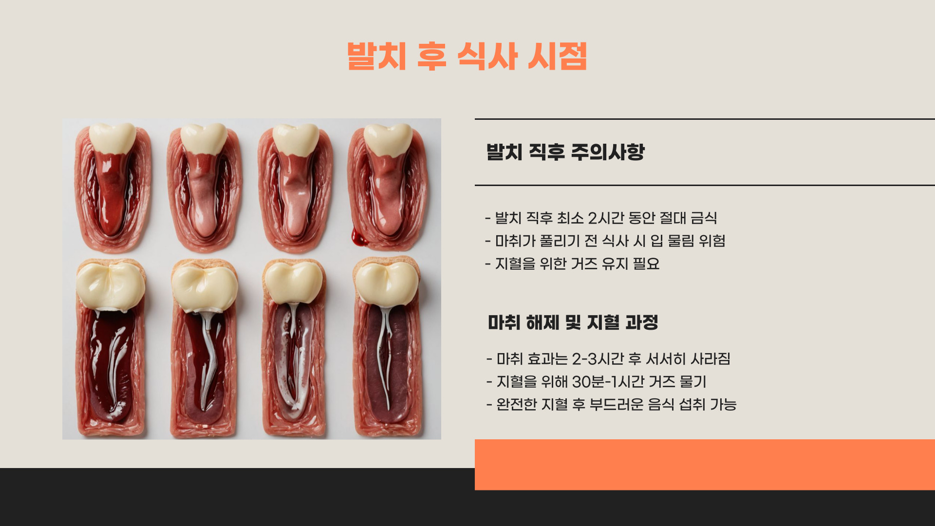 사랑니 발치 후 언제 식사