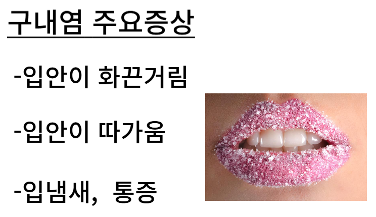 구내염 주요증상 사진