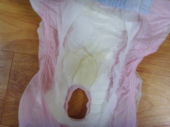 분홍색-기저귀에-대변과-소변을-보아놓은-모습