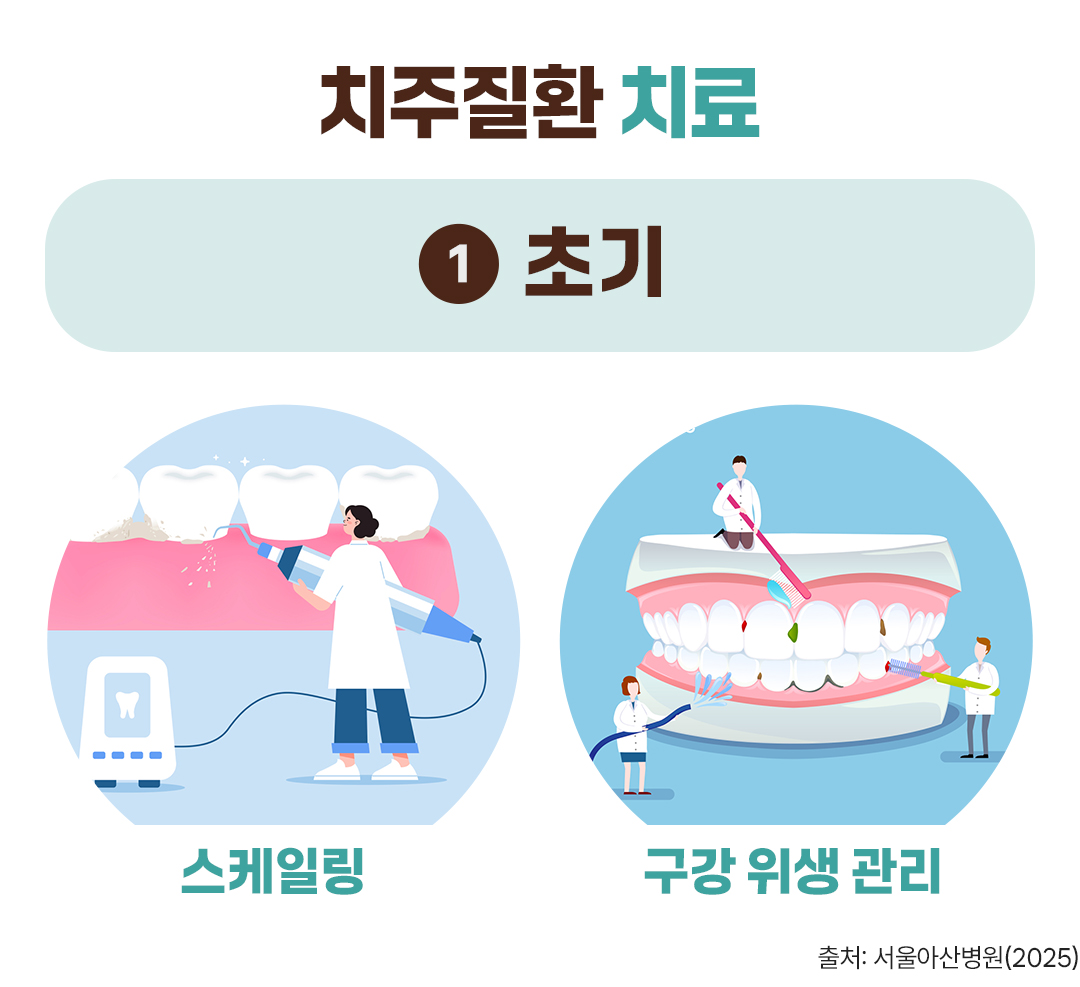 #치주질환 치료 #초기 #스케일링 #구강 위생 관리