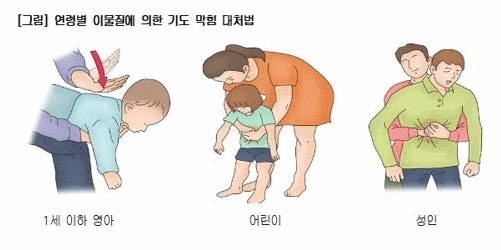 아이가 있는 가정에서 꼭 알아야 할 하임리히법 관련 사진