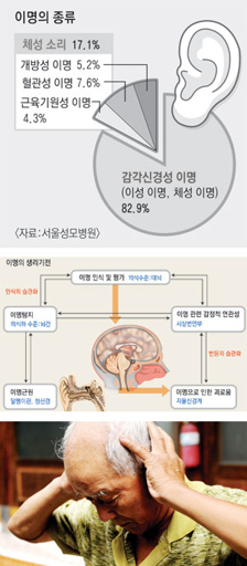 이명증 치료 방법과 효과