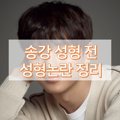 송강 성형전