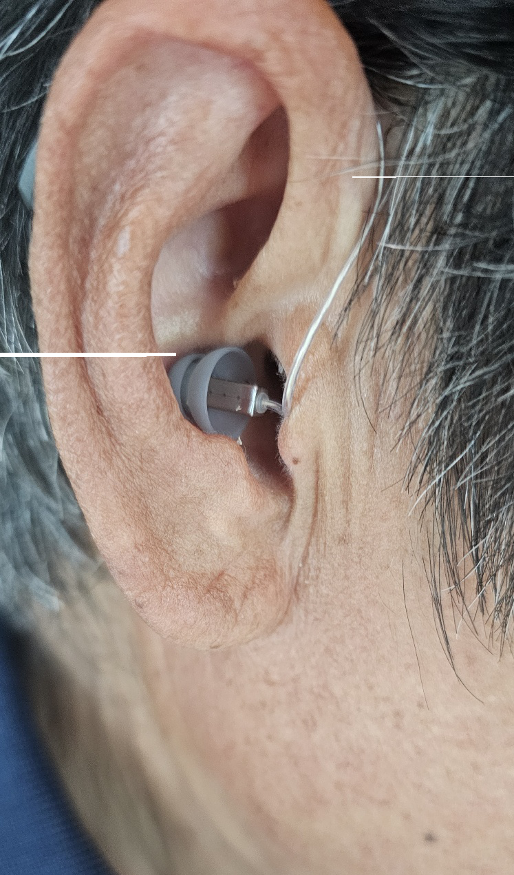 오픈형보청기 귀착용사진