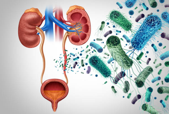 만성 신우신염의 원인과 증상, 진단, 치료와 예방 방법, 합병증