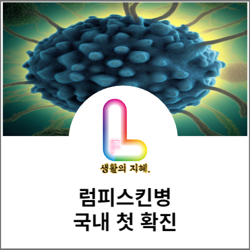 럼피스킨병