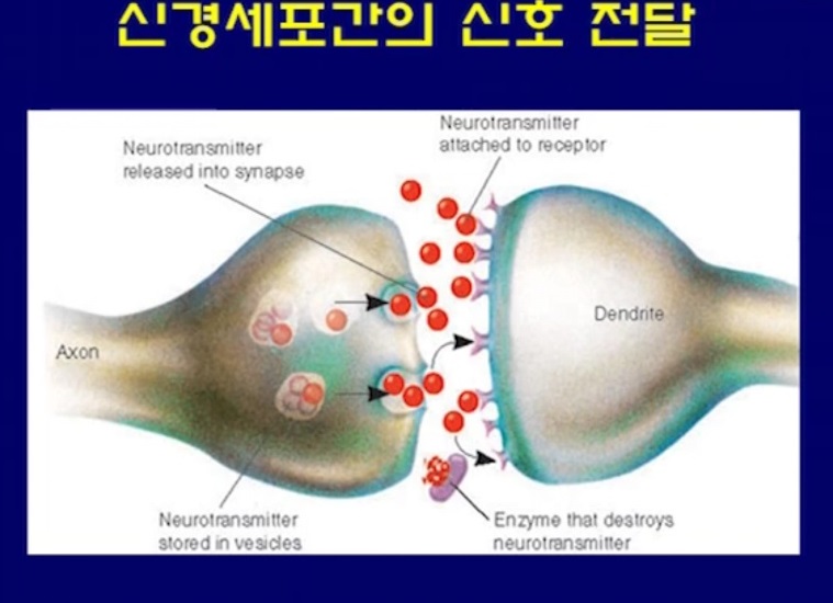 EBS명의-뇌전증-이상건-교수