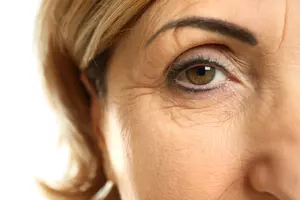 눈밑-주름-없애는-방법