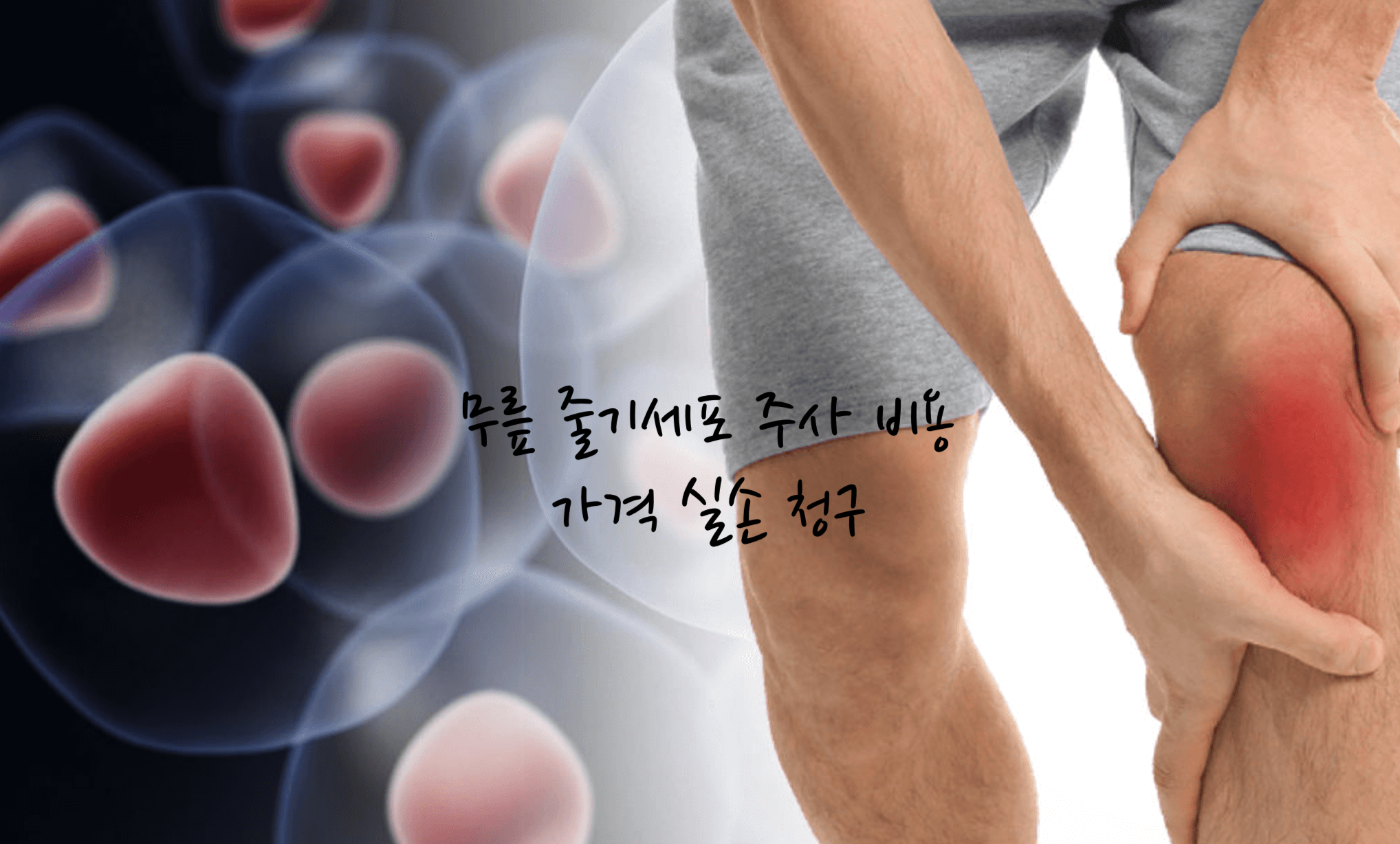 무릎 줄기세포 주사