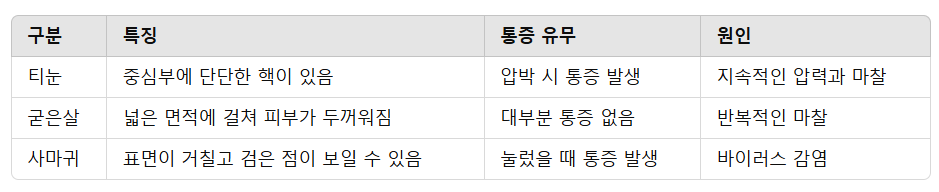 티눈과 굳은살, 사마귀의 차이점
