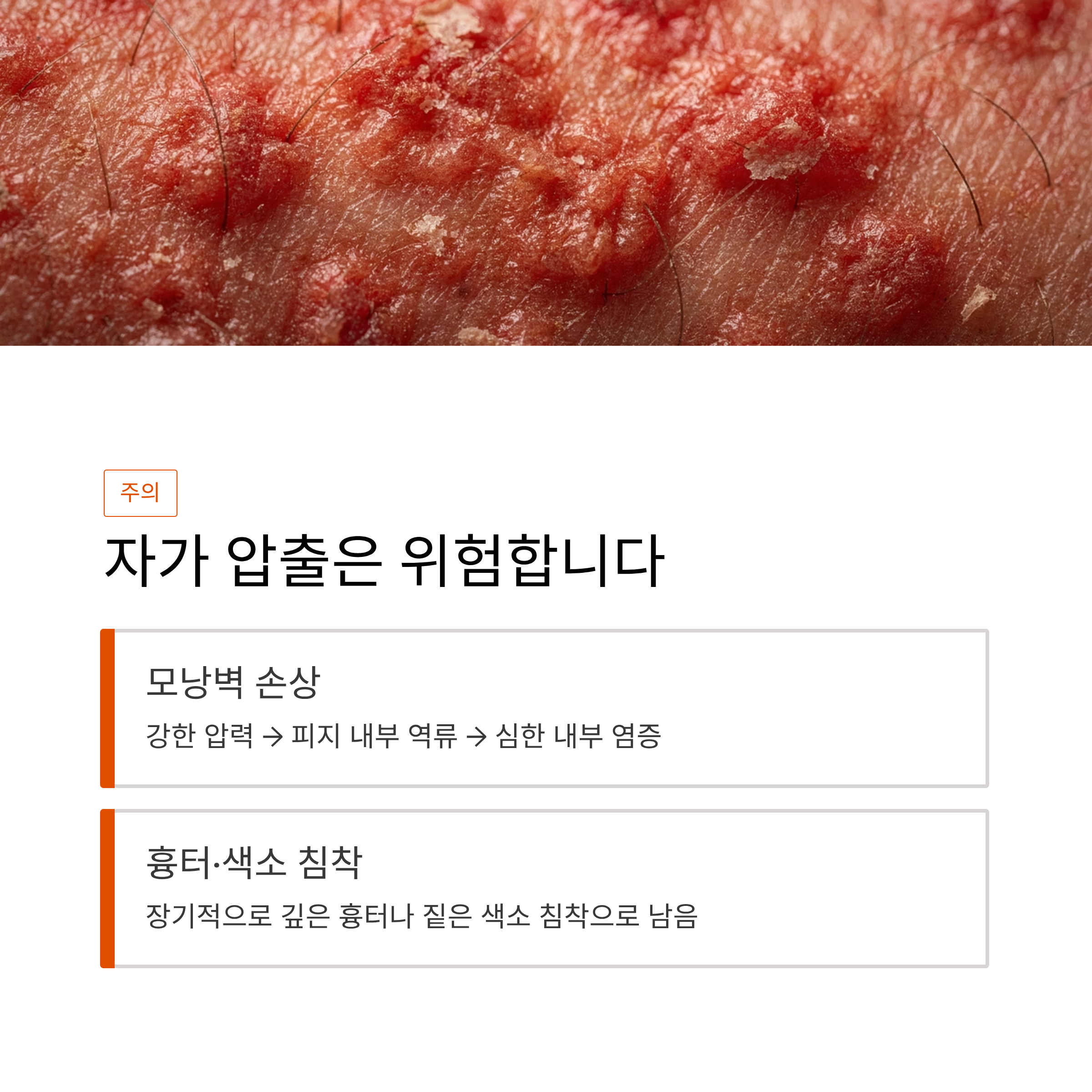 흉터와 색소 침착