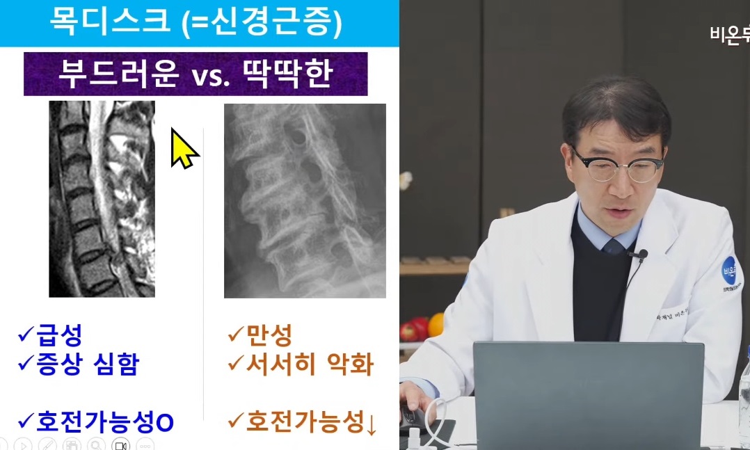 목디스크-목중풍-강경중-교수