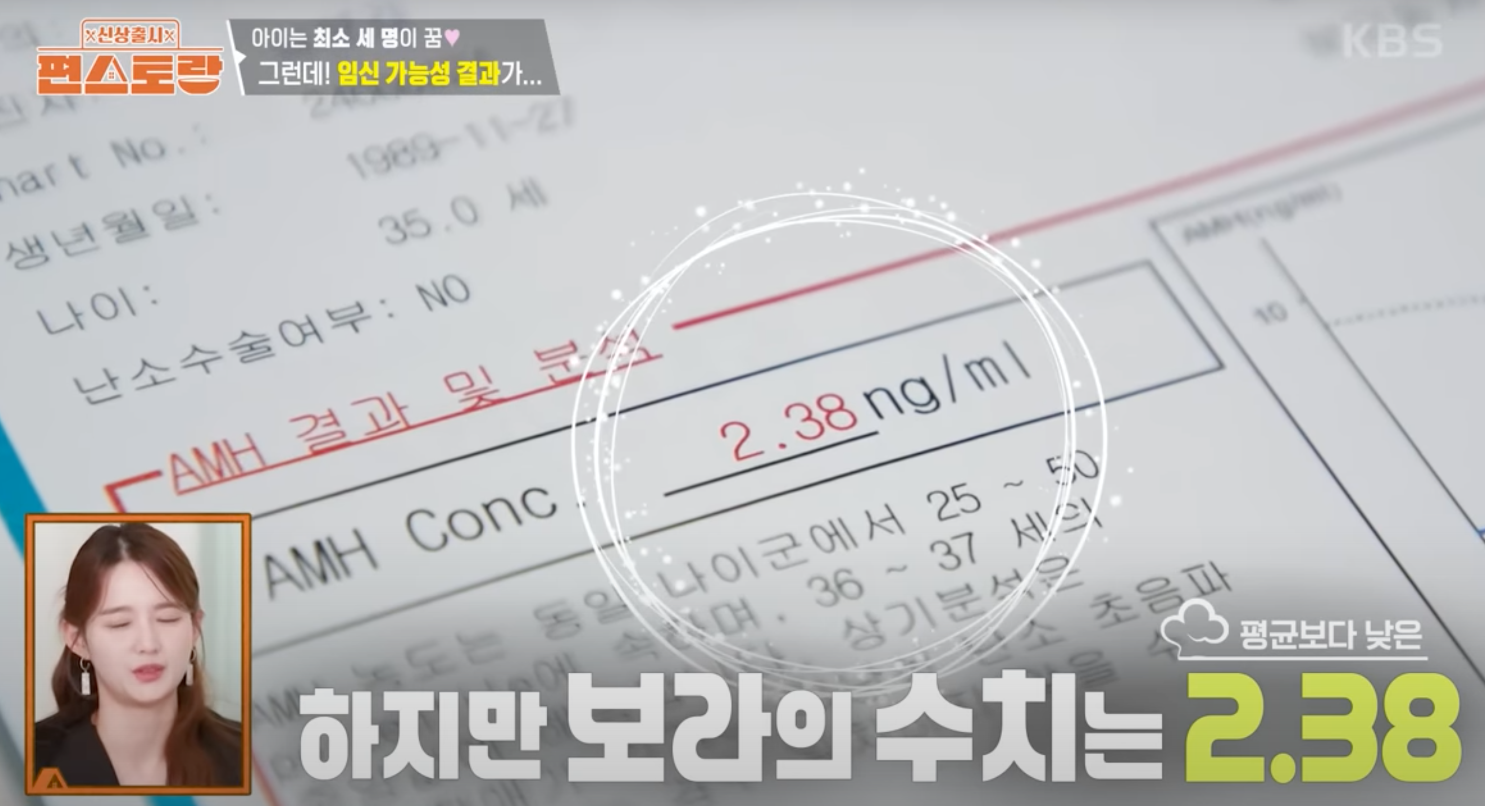 난소나이검사