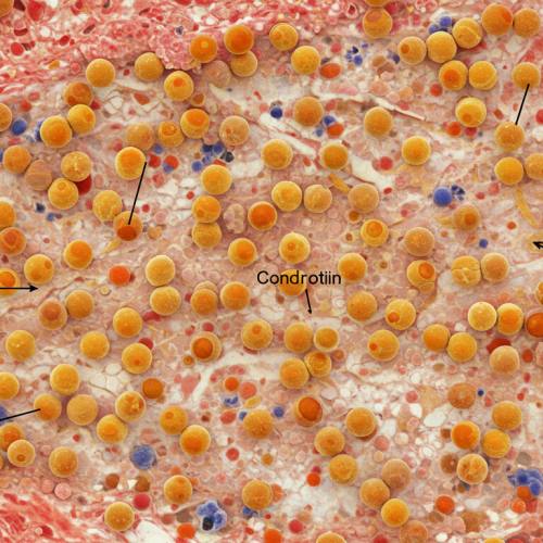콘드로이친 효능