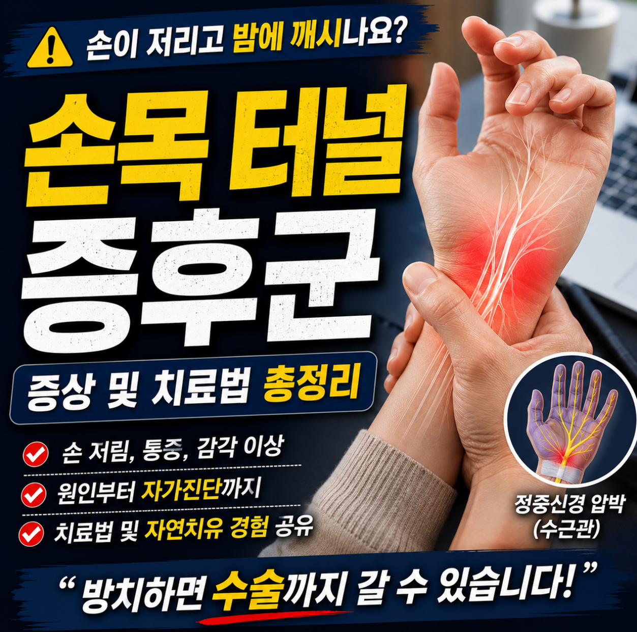 손목 터널 증후군 증상 및 치료법