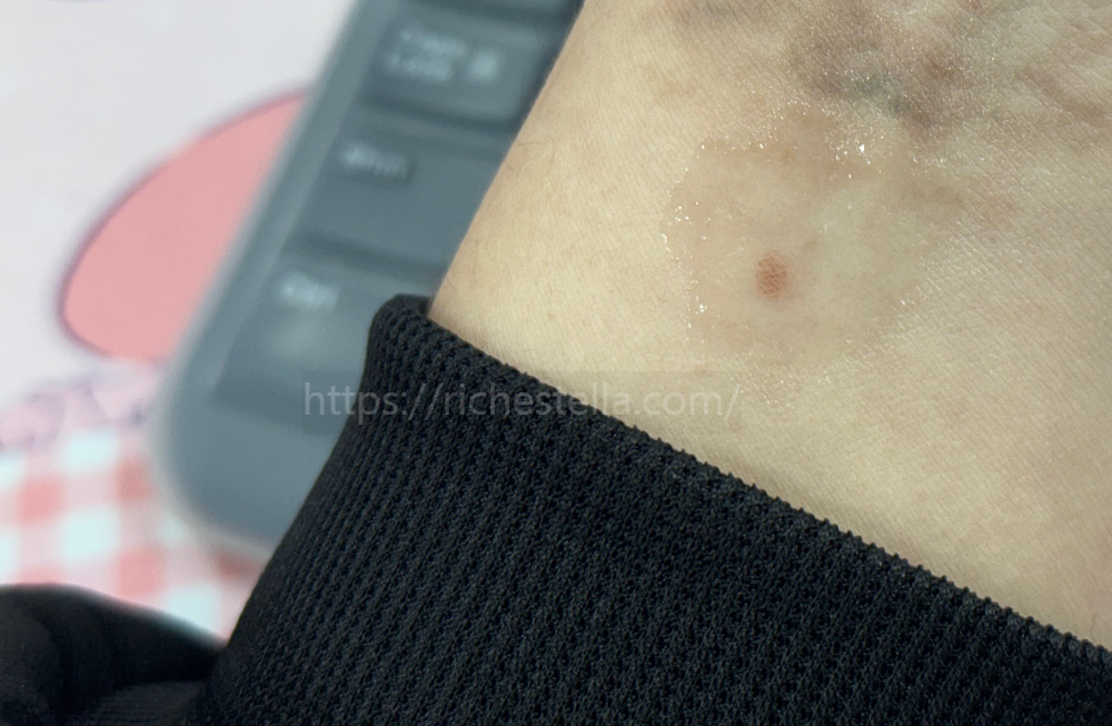 써지엔젤 플러스 실비청구