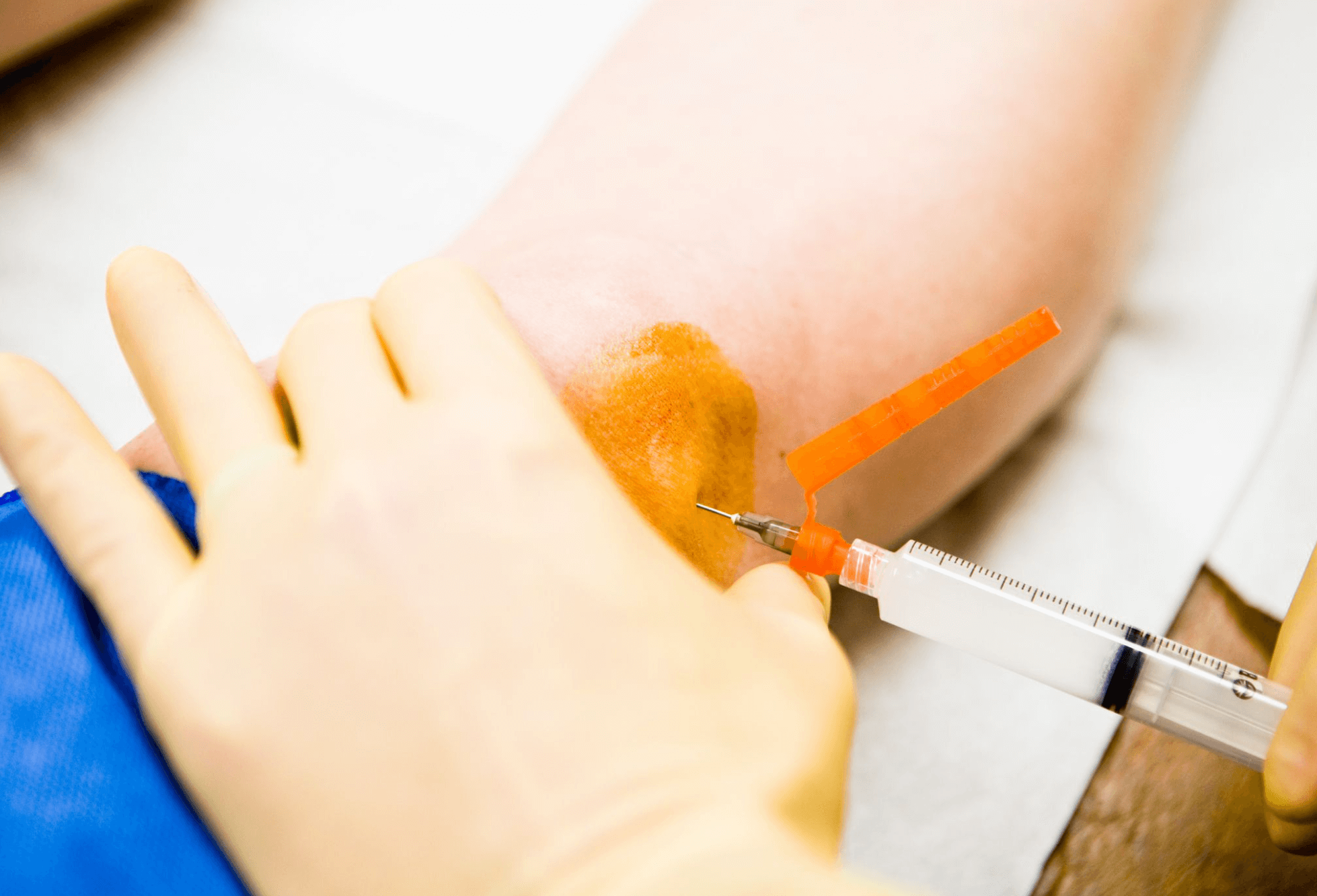 태반주사 부작용