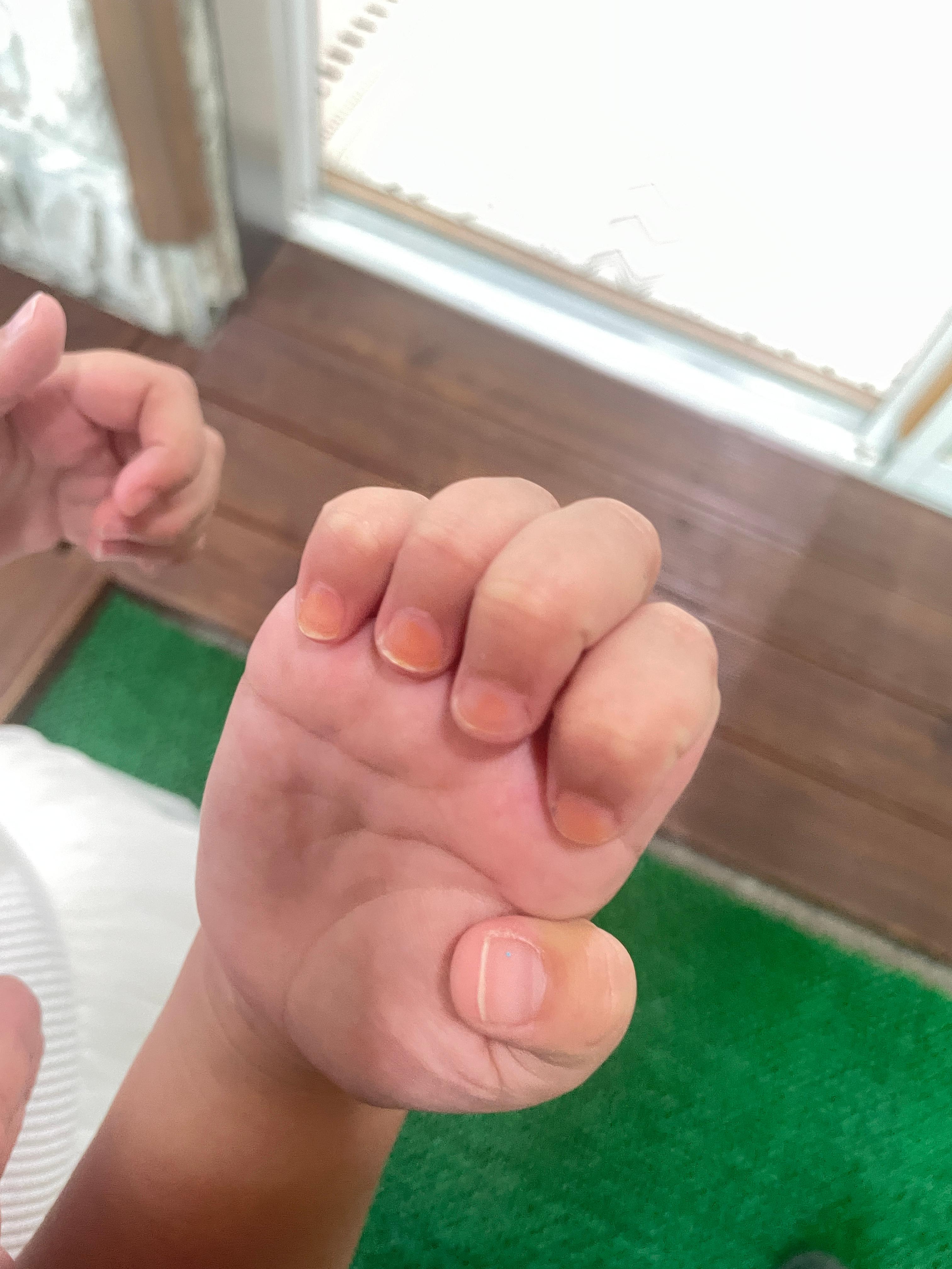 봉선화 꽃잎으로 물들인 손톱 모습