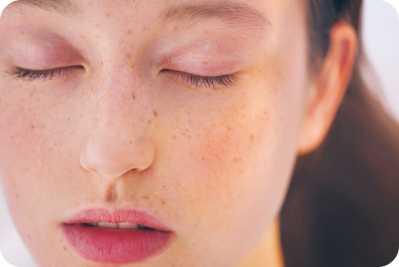 바세린-효능-활용법