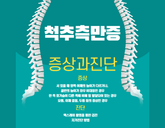 척추측만증과 함께하는 삶, 척추측만증에 대해 알아보자
