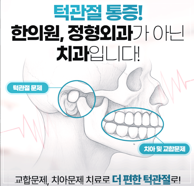 하남 임플란트 가격 