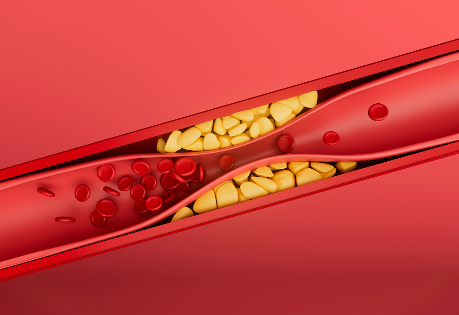 커큐민 효능-산화