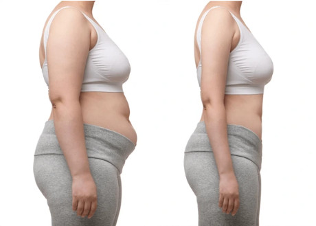 유로바디 베르가못