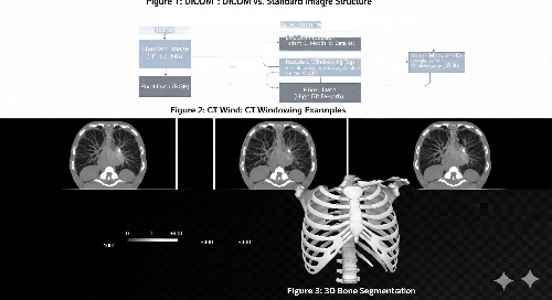 CT 원본 파일에서 윈도잉 설정을 각각 최적화하여 시각화한 결과