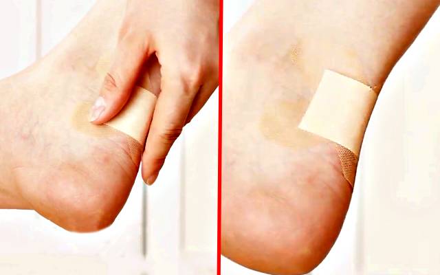 반창고 안떨어지게 붙이는법,발목 밴드 붙이는법