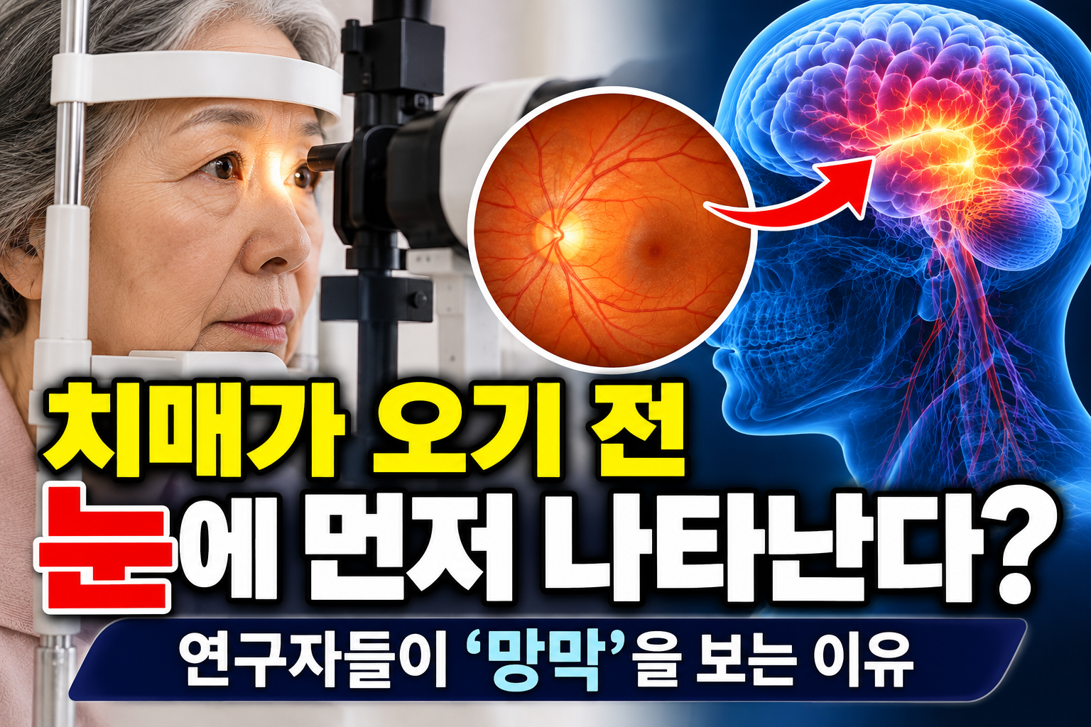 망막 검사를 통해 알츠하이머병 조기 징후를 연구하는 모습