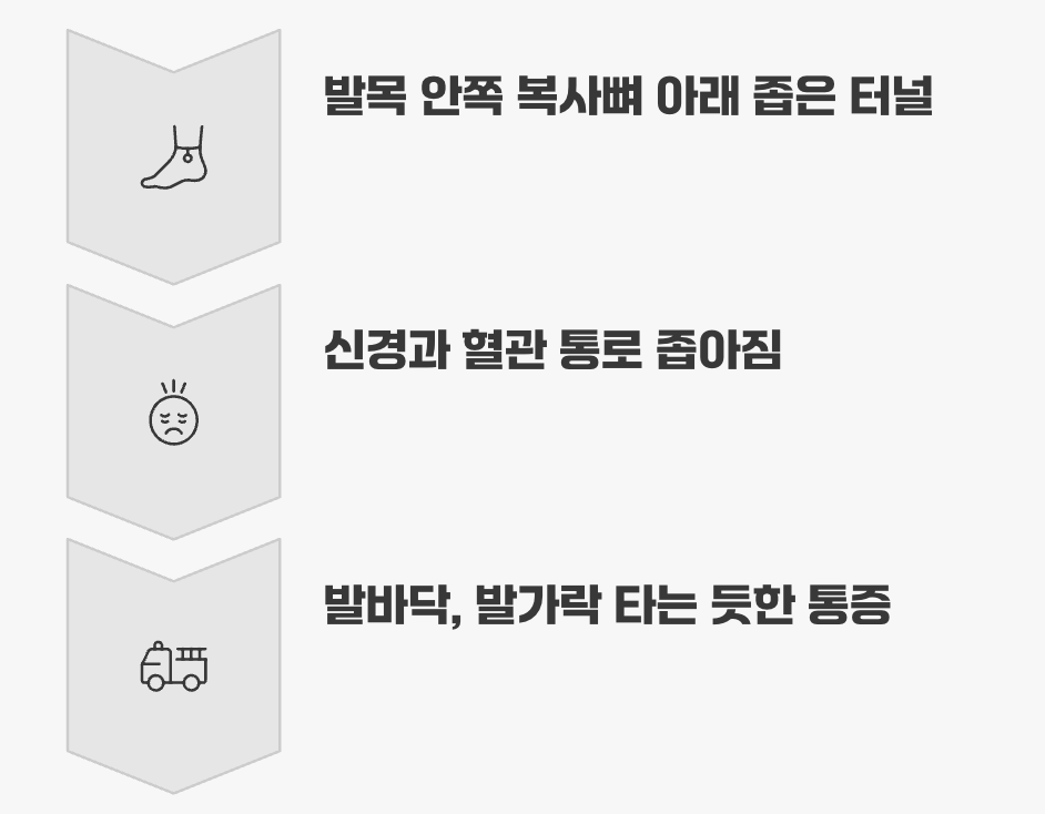 3. 발목 터널 증후군&amp;#44; 발목에서 막힌 신경