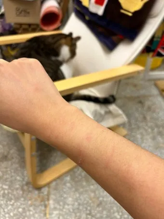 고양이 털 알레르기 완화 방법과 생활 관리 팁_4