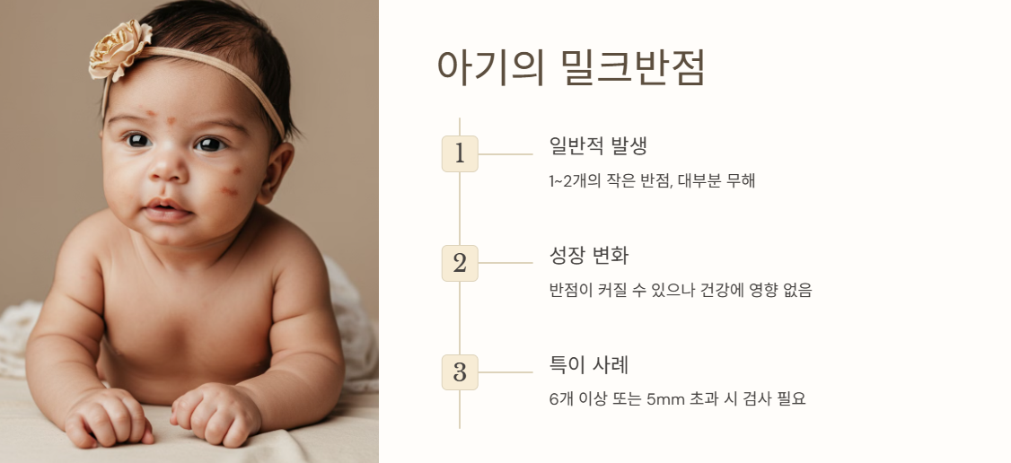 아기에게 나타나는 밀크반점 사례