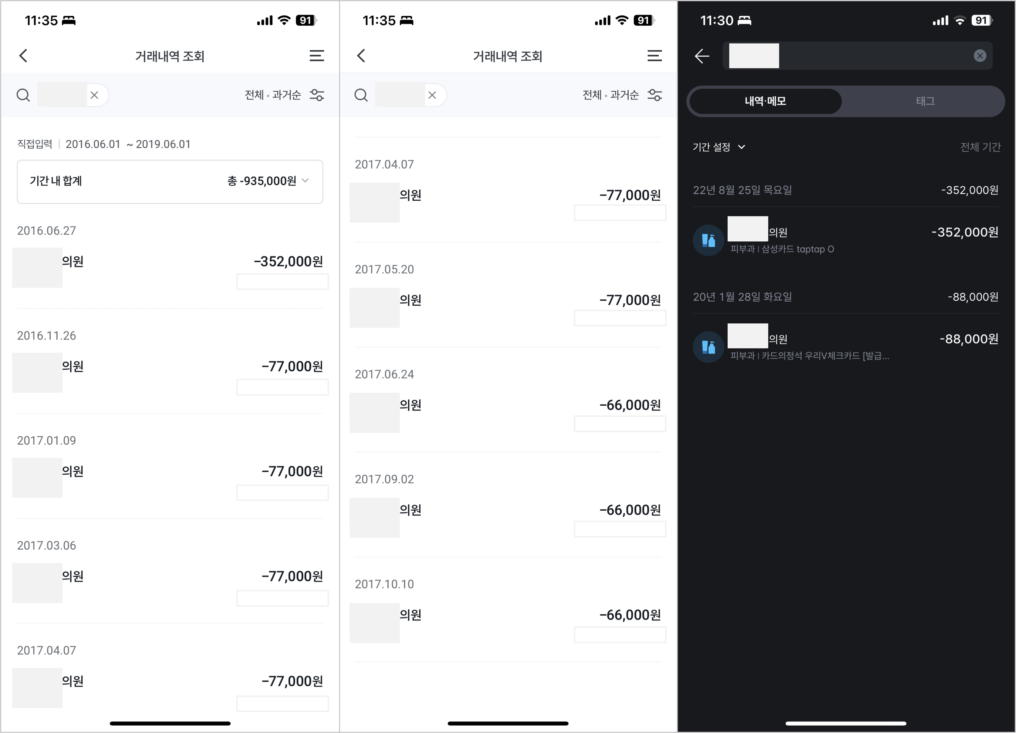 수염 레이저 제모 후기