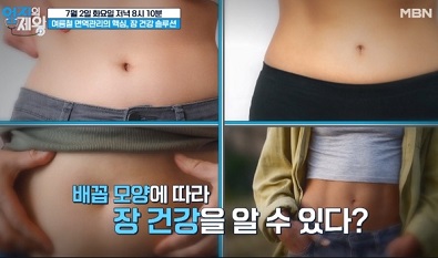 배꼽모양