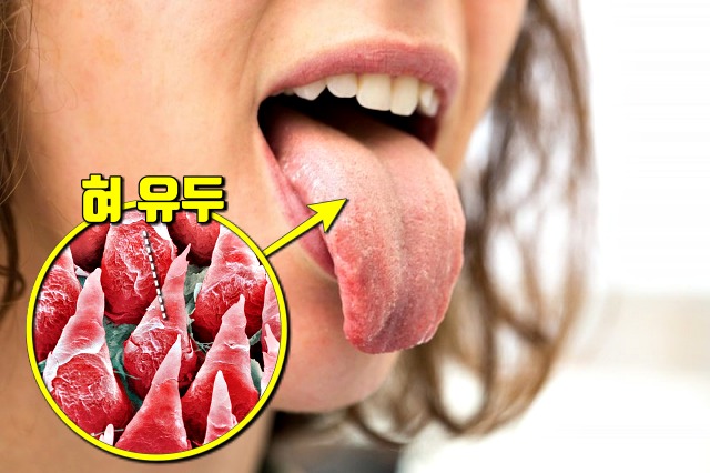 세균 많은 곳 신체부위,혓바닥