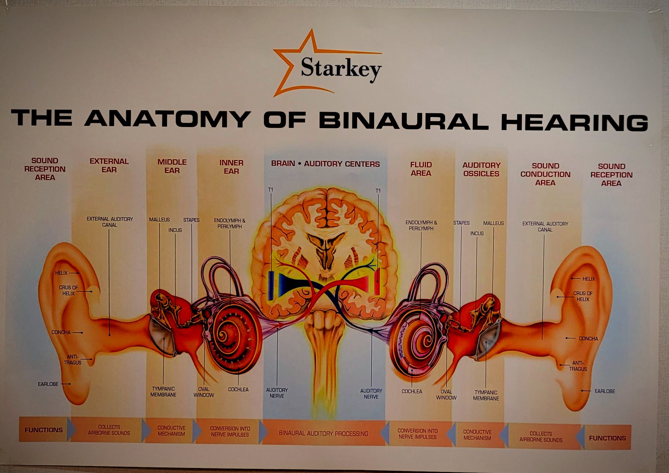 청각장애인의 난청 종류와 분류,난청종류,청각장애인,감각신경성난청,메니에르병,자율신경과민성,언어치료,
청각재활,음성난청,청각훈련,전음성난청,청신경해부도,