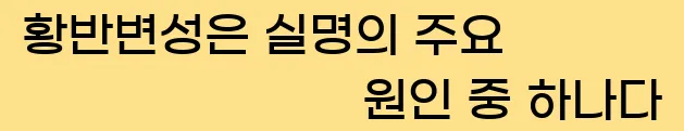  황반변성은 실명의 주요 원인 중 하나다.