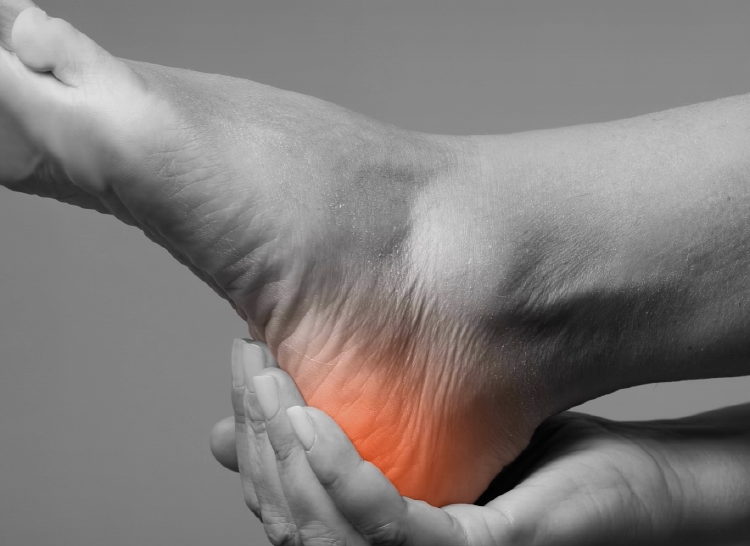 족저 근막염 자가치료