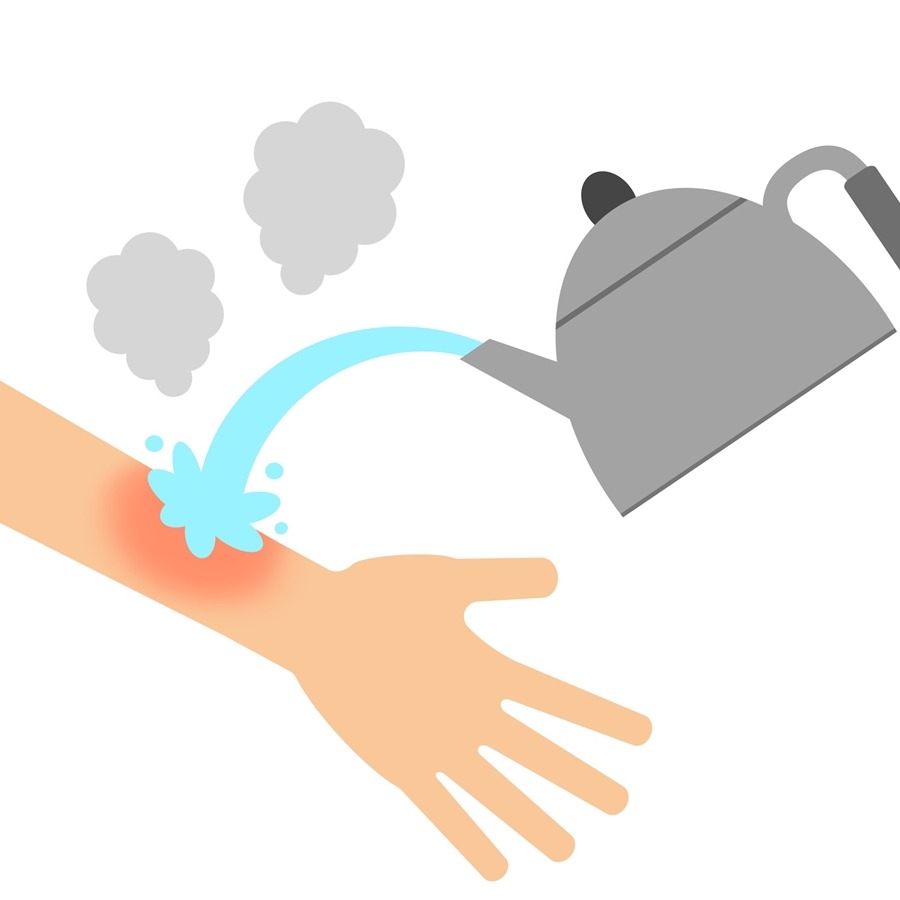 골절/화상/출혈/감전) 응급처치법