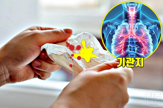 감기 폐렴 독감 기관지염 결핵 증상 가래 기침