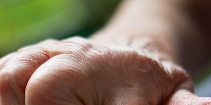 류마티스관절염