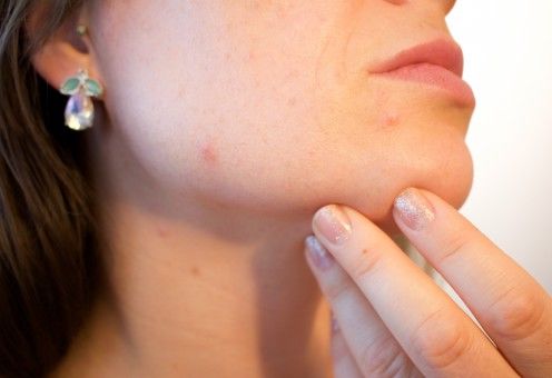 종기가 생기는 이유