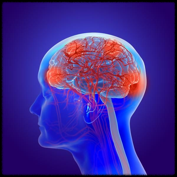 콜라겐과 알츠하이머의 상관관계: 과학적 근거와 이해하기 쉬운 사례